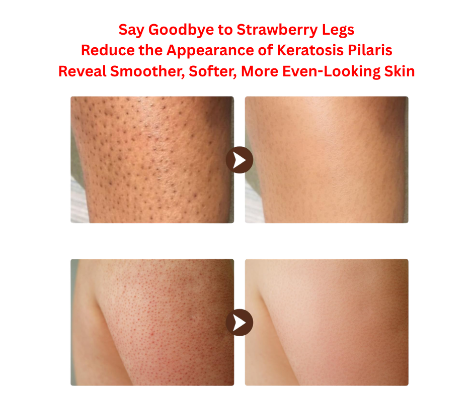 StrawberryFix SmoothSkin Matrix Cream