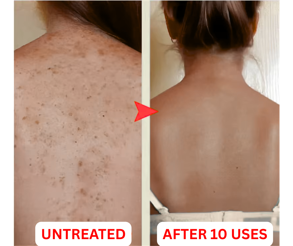 StrawberryFix SmoothSkin Matrix Cream